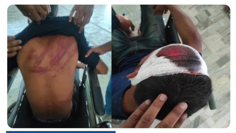 जसपा र कांग्रेसका कार्यकर्ता बिच कुटाकुट