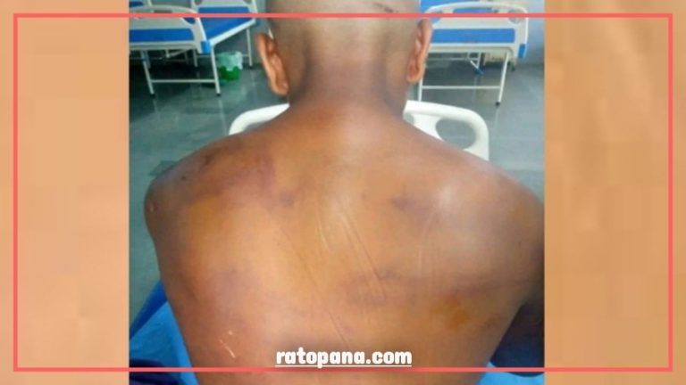 छोरीको प्रेमीलाई भेट्न बोलाएर निर्घाट कुटपिट