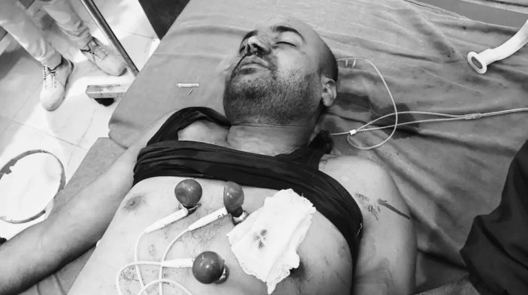 मलङ्गवामा सब–इन्जिनियरको गोली प्रहारबाट हत्या, अनुसन्धान जारी