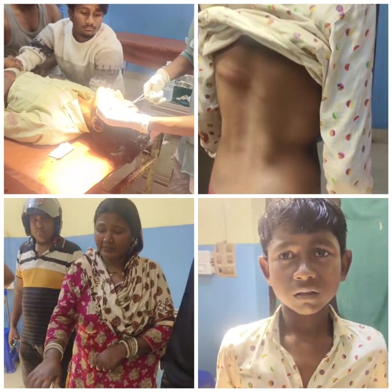 वीरगञ्ज : सशस्त्र प्रहरीको कुटपिटबाट एकै परिवारका तीन जना घाइते